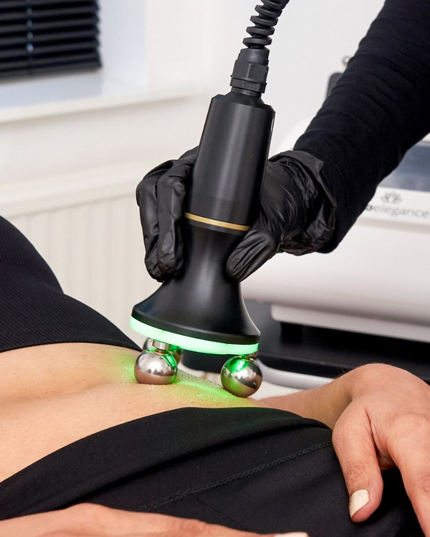 Radiofrequency tummy tightening treatment on the stomach at Neo Elegance Skin Clinic, Derby