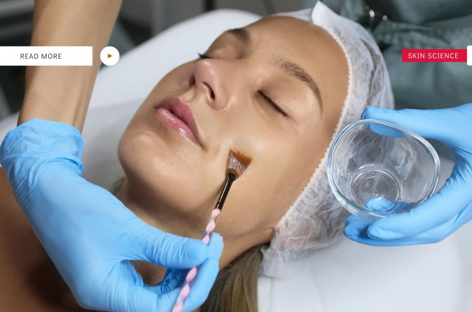 chemical peel benefits derby