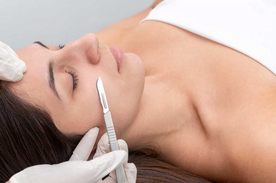 dermaplaning derby
