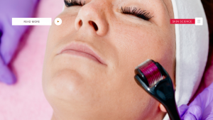 microneedling derby