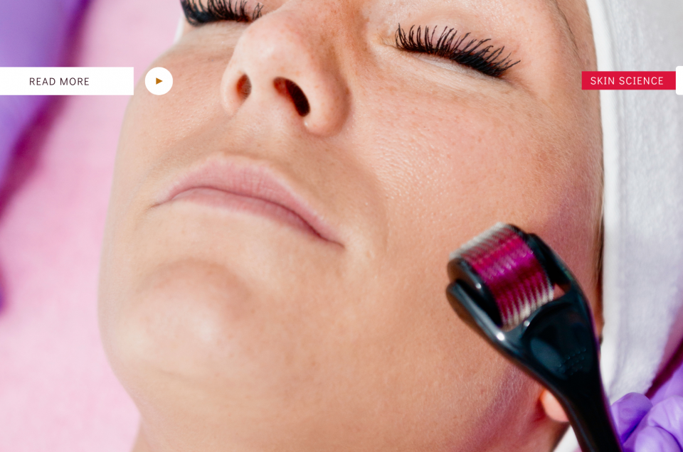 microneedling derby