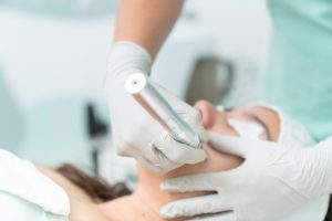 microneedling results timeline
